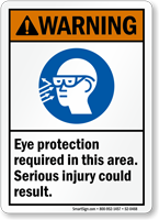Eye Protection Required Injury Possible